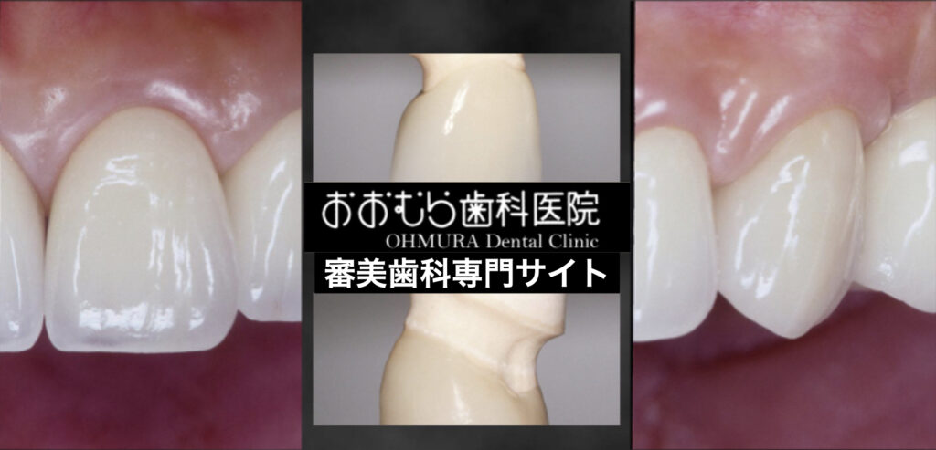 下関市おおむら歯科医院の審美歯科専門ページ